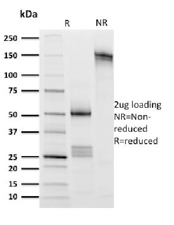 Anti-CD8A (Cytotoxic- & Suppressor T-Cell Marker) Monoclonal Antibody(Clone: UCHT4)