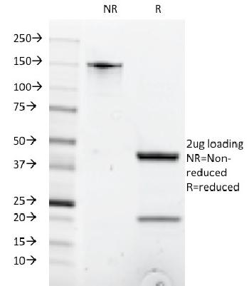 Anti-CD8A (Cytotoxic / Suppressor T-Cell Marker) Monoclonal Antibody(Clone: C8/1035)