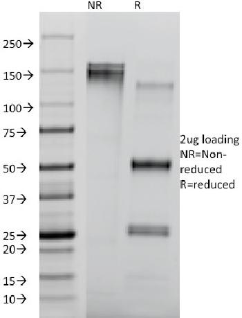 Anti-CD8A (Cytotoxic / Suppressor T-Cell Marker) Monoclonal Antibody(Clone: RIV11)