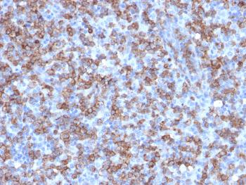 Anti-CD8A (Cytotoxic- & Suppressor T-Cell Marker) Monoclonal Antibody(Clone: C8/1779R)