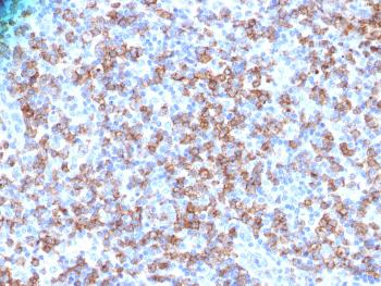 Anti-CD8A (Cytotoxic- & Suppressor T-Cell Marker) Polyclonal Antibody