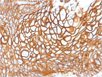 Anti-CD9 (TSPAN29) (Motility-Related Protein-1) Monoclonal Antibody(Clone: CD9/1619)