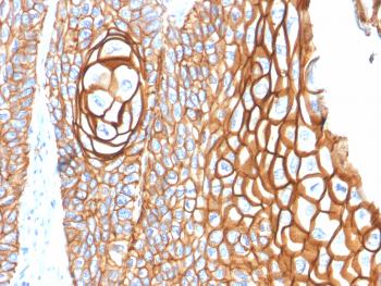 Anti-CD9 (TSPAN29) (Motility-Related Protein-1) Monoclonal Antibody(Clone: P1/33/2)