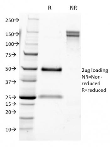 Anti-CD9 (TSPAN29) (Motility-Related Protein-1) Monoclonal Antibody(Clone: CD9/1631)