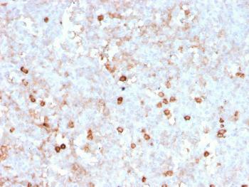 Anti-CD14 (Monocyte / Macrophage Marker) Monoclonal Antibody(Clone: rLPSR/2408)