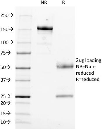 Anti-CD14 (Monocyte / Macrophage Marker) Monoclonal Antibody(Clone: LPSR/553)