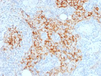 Anti-CD14 (Monocyte / Macrophage Marker) Monoclonal Antibody(Clone: LPSR/2385)