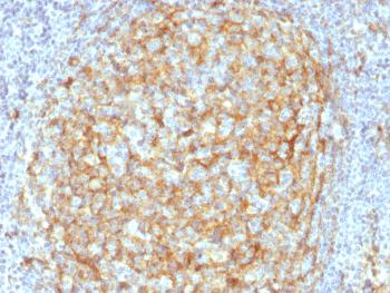 Anti-CD14 (Monocyte / Macrophage Marker) Monoclonal Antibody(Clone: LPSR/2386)