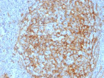 Anti-CD14 (Monocyte / Macrophage Marker) Monoclonal Antibody(Clone: LPSR/2408)