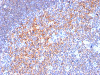 Anti-CD19 (B-Lymphocyte Marker) Monoclonal Antibody(Clone: CD19/3116)