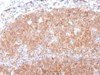 Anti-CD19 (B-Lymphocyte Marker) Monoclonal Antibody(Clone: CD19/3117)