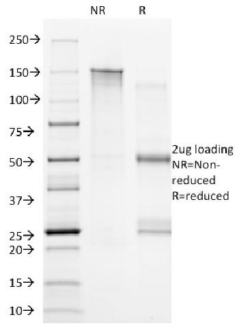 Anti-CD20 / MS4A1 (B-Cell Marker) Monoclonal Antibody(Clone: B9E9)