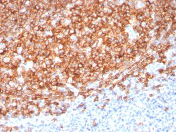 Anti-CD20 / MS4A1 (B-Cell Marker) Monoclonal Antibody(Clone: MS4A1/3410)