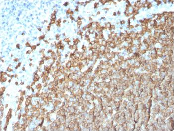 Anti-CD20/ MS4A1 (B-Cell Marker) Monoclonal Antibody(Clone: MS4A1/3411)