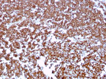 Anti-CD20 / MS4A1 (B-Cell Marker) Monoclonal Antibody(Clone: MS4A1/3409)