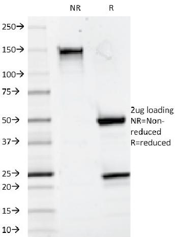 Anti-CD20 / MS4A1 (B-Cell Marker) Monoclonal Antibody(Clone: 93-1B3)