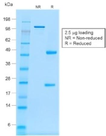 Anti-CD20 / MS4A1 (B-Cell Marker) Monoclonal Antibody(Clone: rIGEL/773)