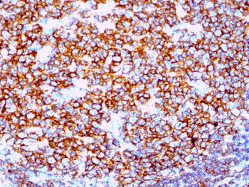 Anti-CD20 / MS4A1 (B-Cell Marker) Monoclonal Antibody(Clone: IGEL/1497R)