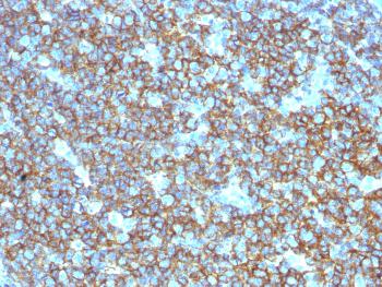 Anti-CD20 / MS4A1 (B-Cell Marker) Polyclonal Antibody