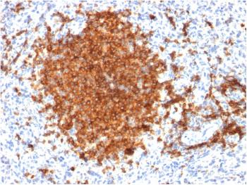 Anti-CD22 / BL-CAM (B-Cell Marker) Monoclonal Antibody(Clone: BLCAM/1795)