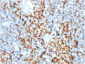 Anti-CD163 (Monocyte & Macrophage Marker) Monoclonal Antibody(Clone: M130/1210)