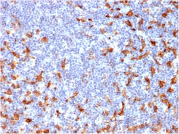 Anti-CD163 (Monocyte & Macrophage Marker) Monoclonal Antibody(Clone: M130/2162)