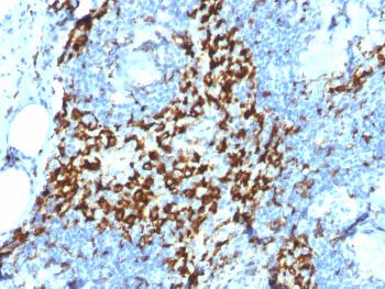 Anti-CD163 (Monocyte & Macrophage Marker) Monoclonal Antibody(Clone: M130/2164)