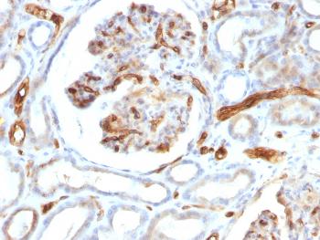 Anti-Adiponectin (Marker of Obesity) Monoclonal Antibody(Clone: ADPN/1370)