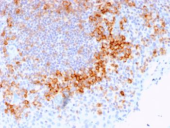 Anti-CD27 (Tumor Necrosis Factor Receptor Superfamily 7) Monoclonal Antibody(Clone: LPFS2/1611)