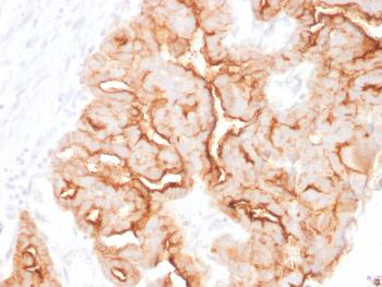 Anti-MUC16 / CA125 (Ovarian Carcinoma Marker) Monoclonal Antibody(Clone: MUC16/1860)