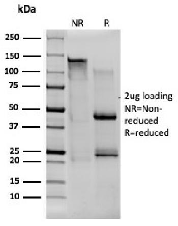 Anti-CD80 (B7-1) Monoclonal Antibody(Clone: C80/1608)