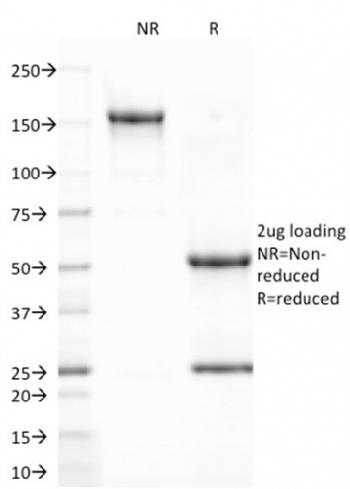 Anti-CD80 (B7-1) Monoclonal Antibody(Clone: C80/2723)