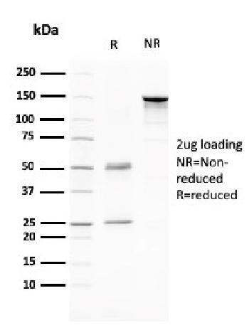 Anti-CD80 (B7-1) Monoclonal Antibody(Clone: C80/2776)