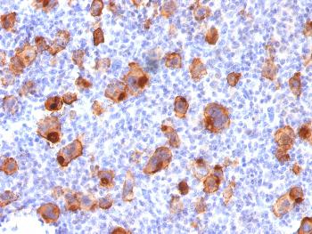 Anti-CD30 / TNFRSF8 (Hodgkin & Reed-Sternberg Cell Marker) Monoclonal Antibody(Clone: rKi-1/779)