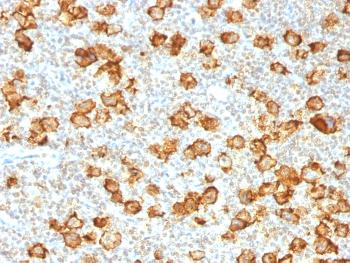 Anti-CD30 / TNFRSF8 (Hodgkin & Reed-Sternberg Cell Marker) Monoclonal Antibody(Clone: Ki-1/1505R)