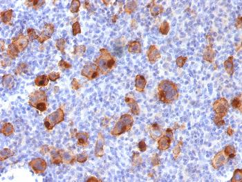 Anti-CD30 / TNFRSF8 (Hodgkin & Reed-Sternberg Cell Marker) Monoclonal Antibody(Clone: Ki-1/1747R)