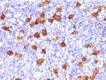 Anti-CD30 / TNFRSF8 (Hodgkin & Reed-Sternberg Cell Marker) Polyclonal Antibody