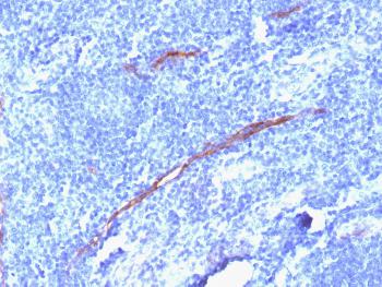 Anti-CD34 (Hematopoietic Stem Cell & Endothelial Marker) Monoclonal Antibody(Clone: HPCA1/1806R)