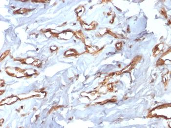 Anti-CD34 (Hematopoietic Stem Cell & Endothelial Marker) Monoclonal Antibody(Clone: HPCA1/2598R)