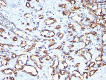 Anti-CD34 (Hematopoietic Stem Cell & Endothelial Marker) Polyclonal Antibody