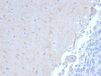 Anti-ATG5 (Autophagy Marker) Monoclonal Antibody(Clone: ATG5/2101)