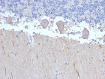 Anti-ATG5 (Autophagy Marker) Monoclonal Antibody(Clone: ATG5/2492)