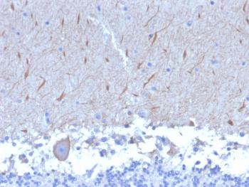 Anti-ATG5 (Autophagy Marker) Monoclonal Antibody(Clone: ATG5/2553)