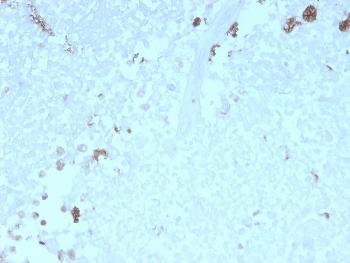 Anti-ATG5 (Autophagy Marker) Monoclonal Antibody(Clone: rATG5/2553)