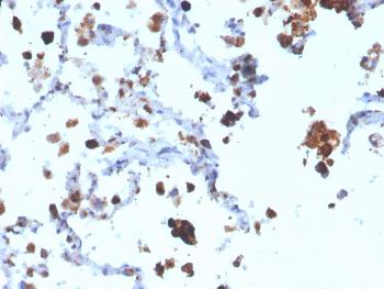 Anti-Napsin A (Lung Adenocarcinoma Marker) Monoclonal Antibody(Clone: NAPSA/3308)