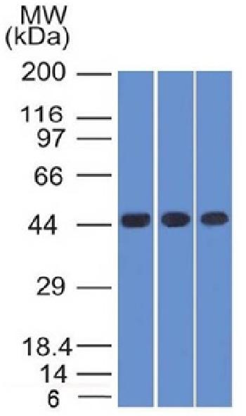 Anti-Napsin A (Lung Adenocarcinoma Marker) Monoclonal Antibody(Clone: NAPSA/1238)