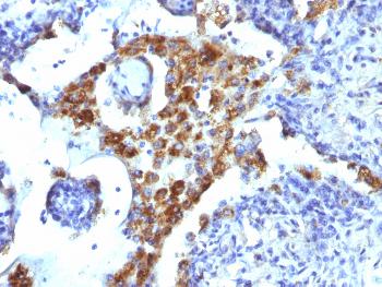 Anti-Napsin A (Lung Adenocarcinoma Marker) Monoclonal Antibody(Clone: NAPSA/1239)