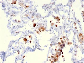 Anti-Napsin A (Lung Adenocarcinoma Marker) Monoclonal Antibody(Clone: NAPSA/3306)