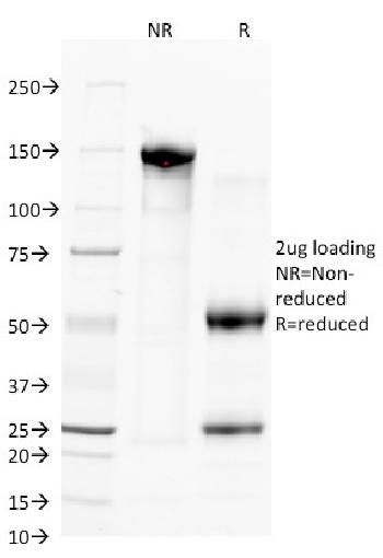 Anti-CD38 (ADP Ribosyl Cyclase 1) Monoclonal Antibody(Clone: FS02)