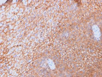 Anti-CD40 Ligand / CD154 / TRAP1 (Activation Marker of T-Lymphocytes) Monoclonal Antibody(Clone: CD40LG/2761)